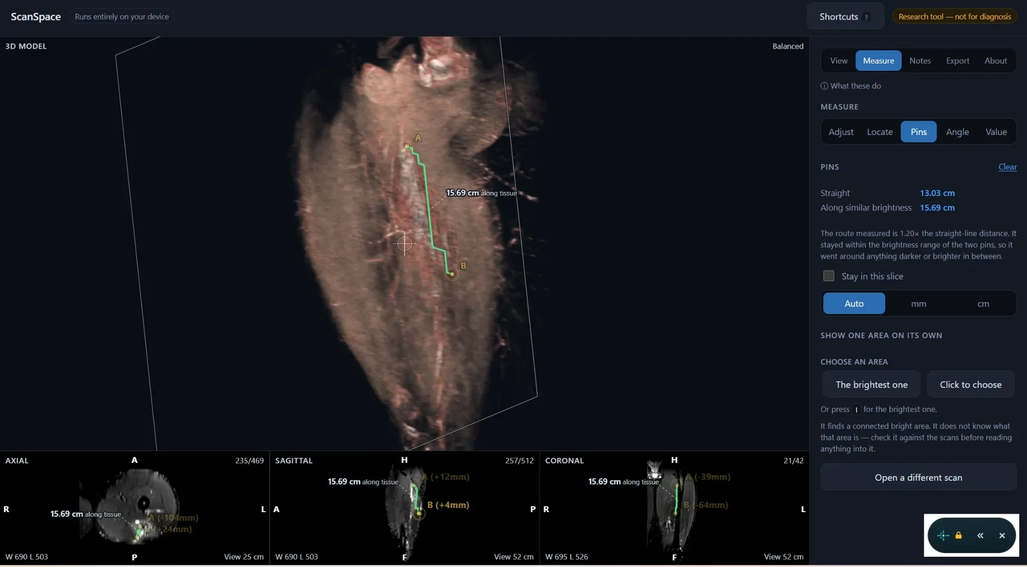 Innerslice's Measure tab, with pins A and B placed on a hamstring MRI rendered in 3D and a green route traced between them through the tissue. A readout gives the straight-line distance as 13.03 cm and the routed distance as 15.69 cm, and the same measurement is drawn on the axial, sagittal and coronal slices below.