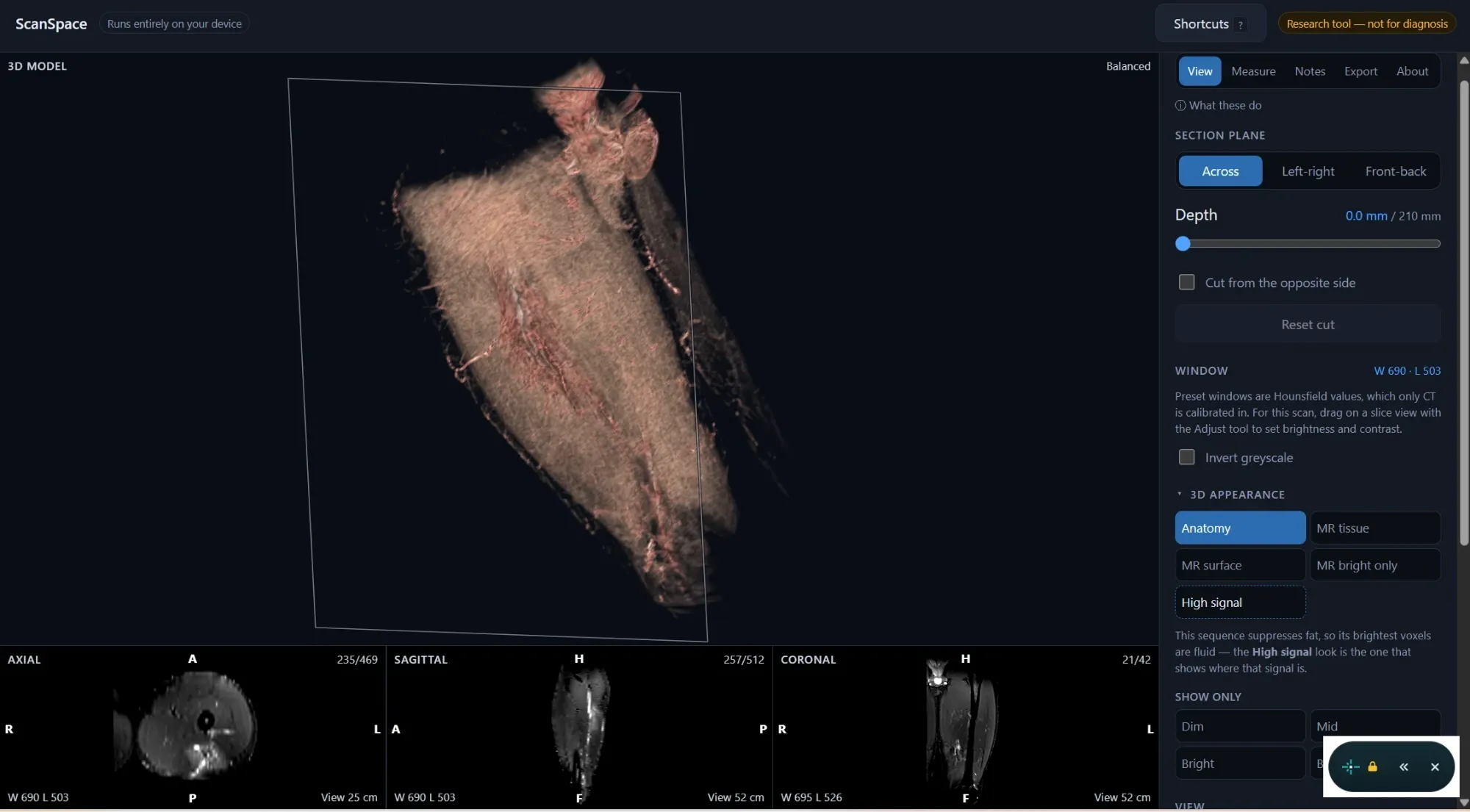 The View tab with the section plane at zero depth, showing the whole hamstring scan rendered as one solid object in a three-quarter view, beside controls for cut direction, depth, brightness window and tissue appearance.