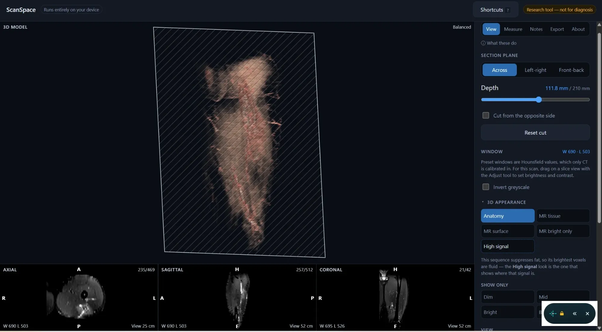 ScanSpace showing a hamstring MRI as a rotatable 3D model with a section plane cutting through it at 111.8 mm of 210 mm, beside controls for the cut direction, depth, brightness window and tissue appearance, with axial, sagittal and coronal slices along the bottom.